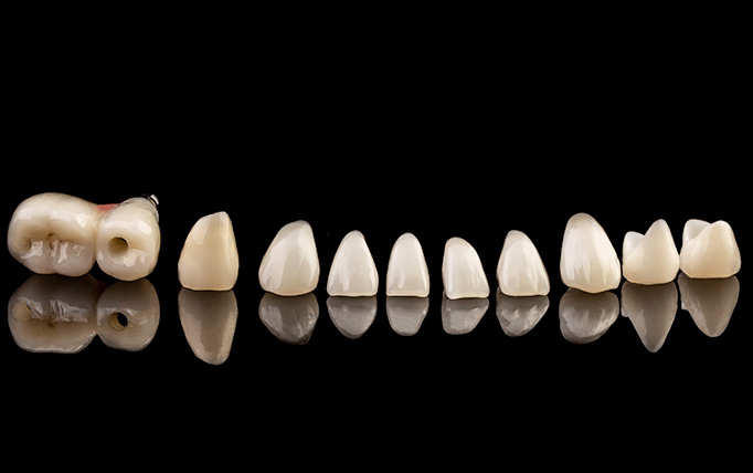 セラミックの詰め物や被せ物（自由診療）