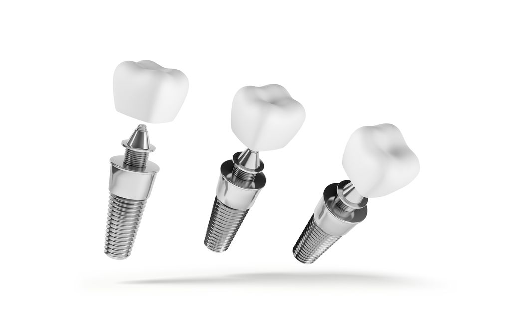 治療期間はどれくらいかかりますか？